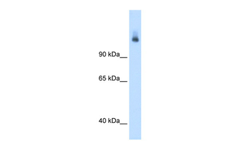 CPS1 Rabbit Polyclonal Antibody