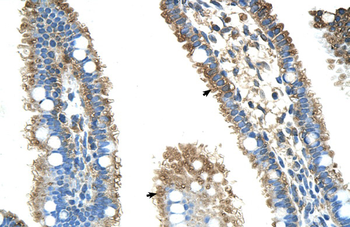 ALDH4A1 Rabbit Polyclonal Antibody