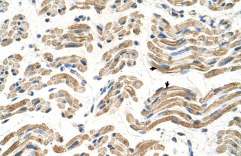 ALDH4A1 Rabbit Polyclonal Antibody