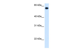 ALDH4A1 Rabbit Polyclonal Antibody