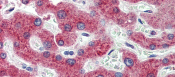 HSD11B1 Rabbit Polyclonal Antibody