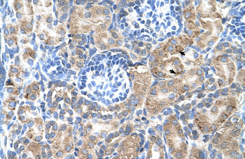 SGPP2 Rabbit Polyclonal Antibody