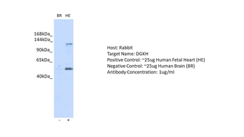 DGKH Rabbit Polyclonal Antibody