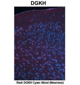 DGKH Rabbit Polyclonal Antibody