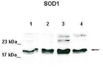 SOD1 Rabbit Polyclonal Antibody