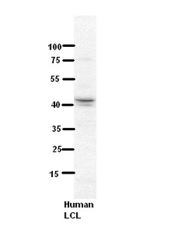 NDUFV3 Rabbit Polyclonal Antibody