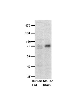PFKL Rabbit Polyclonal Antibody