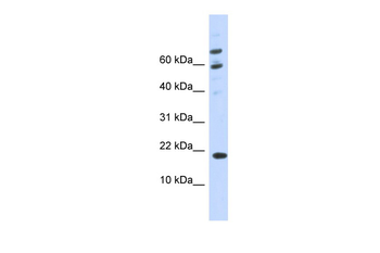 C21orf87 Rabbit Polyclonal Antibody