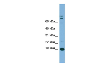 TFF1 Rabbit Polyclonal Antibody