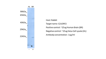 CFAP410 Rabbit Polyclonal Antibody