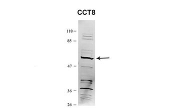 CCT8 Rabbit Polyclonal Antibody