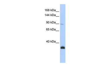 MORC3 Rabbit Polyclonal Antibody