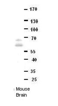 DONSON Rabbit Polyclonal Antibody