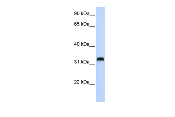 C21orf62 Rabbit Polyclonal Antibody