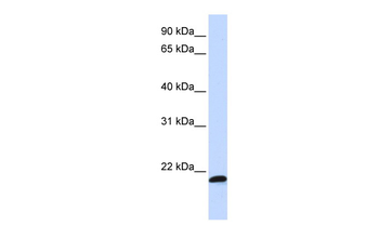C21orf56 Rabbit Polyclonal Antibody