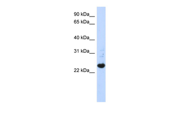 C21orf56 Rabbit Polyclonal Antibody