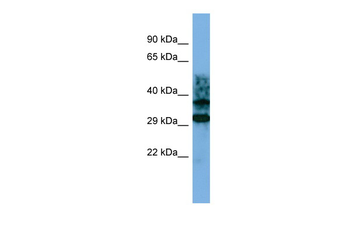 CRYZL1 Rabbit Polyclonal Antibody