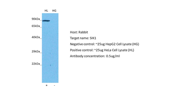 SNF1LK Rabbit Polyclonal Antibody