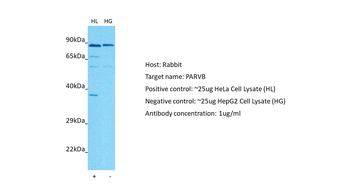 PARVB Rabbit Polyclonal Antibody