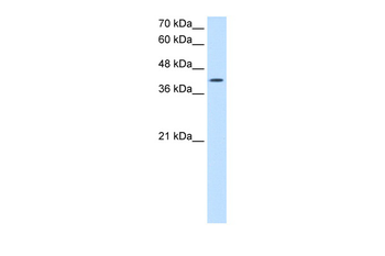 ACTR2 Rabbit Polyclonal Antibody