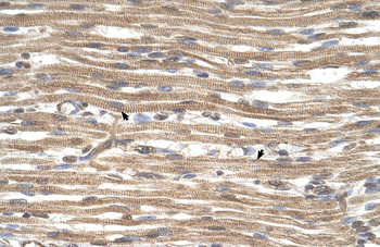 ACTR2 Rabbit Polyclonal Antibody