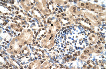 IFIT3 Rabbit Polyclonal Antibody