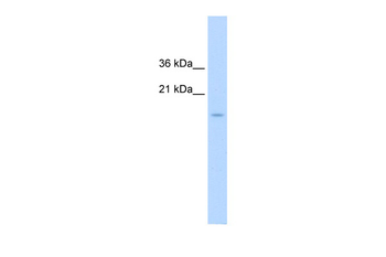 CENPA Rabbit Polyclonal Antibody