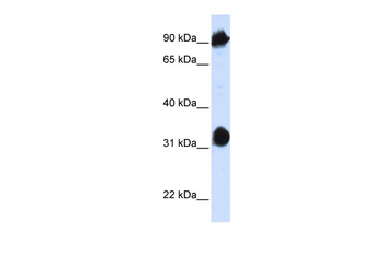 HSPA4 Rabbit Polyclonal Antibody