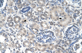PPAT Rabbit Polyclonal Antibody