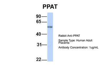 PPAT Rabbit Polyclonal Antibody