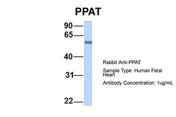 PPAT Rabbit Polyclonal Antibody