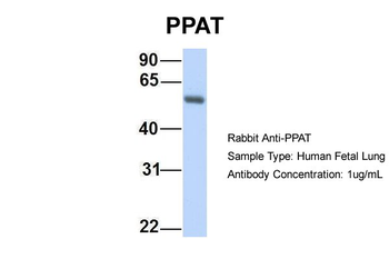 PPAT Rabbit Polyclonal Antibody