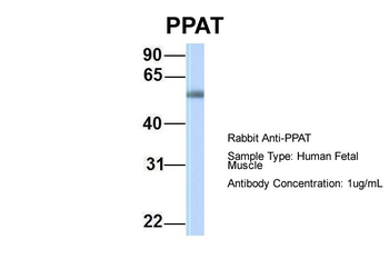 PPAT Rabbit Polyclonal Antibody