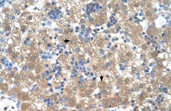 PEX3 Rabbit Polyclonal Antibody