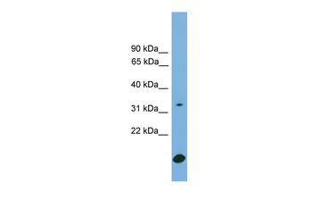 RAB9A Rabbit Polyclonal Antibody