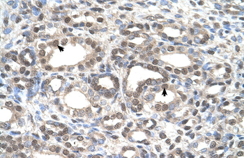 GSDME Rabbit Polyclonal Antibody