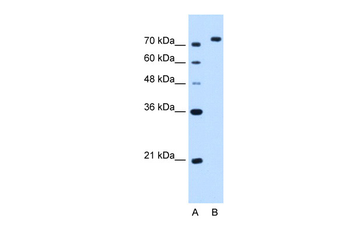 NOLC1 Rabbit Polyclonal Antibody