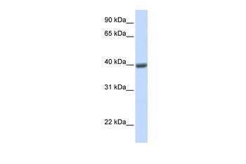 MAGEA1 Rabbit Polyclonal Antibody