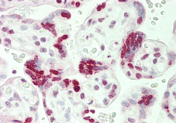 HIST1H1C Rabbit Polyclonal Antibody