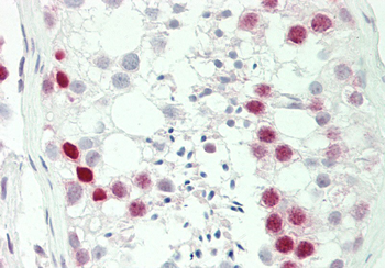 HIST1H1C Rabbit Polyclonal Antibody