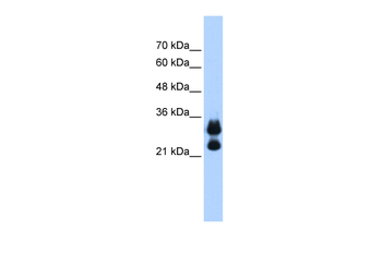 HIST1H1C Rabbit Polyclonal Antibody