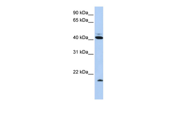 UBD Rabbit Polyclonal Antibody