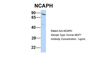 NCAPH Rabbit Polyclonal Antibody