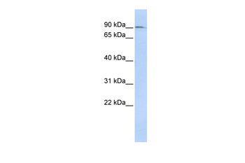 NCAPH Rabbit Polyclonal Antibody
