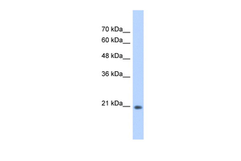 GINS2 Rabbit Polyclonal Antibody