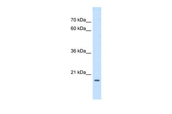 ASF1B Rabbit Polyclonal Antibody
