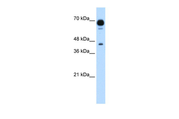 PUS7 Rabbit Polyclonal Antibody