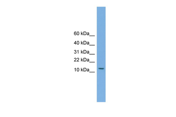 MAGEA5 Rabbit Polyclonal Antibody
