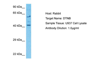DTNB Rabbit Polyclonal Antibody