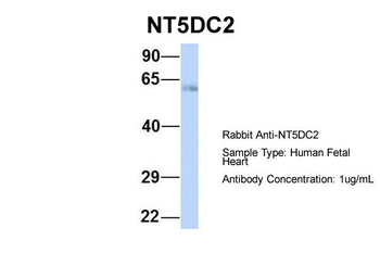NT5DC2 Rabbit Polyclonal Antibody